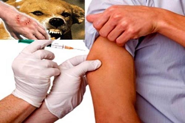 تأخير الإعلان عن البعثات والمنح الخارجية يحرم طلاب جامعاتنا منها.. المئات عرضة لأنياب الكلاب الشاردة ومشافي الصحة بلا مصول.. ومعنيوها لا يهمهم الأمر!!