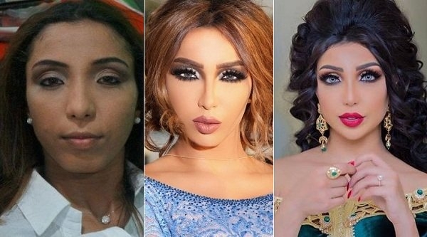 دنيا بطمة تنكر قيامها بعمليات التجميل