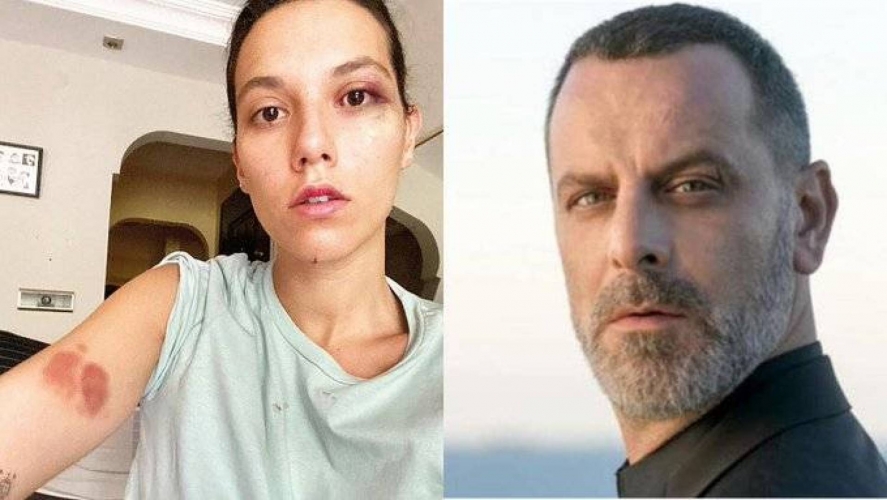 الحكم بسجن ممثل تركي شهير 13 عاما لاعتدائه على حبيبته