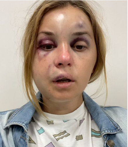 مذيعة أوكرانية تتعرض لمحاولة اغتصاب في القطار