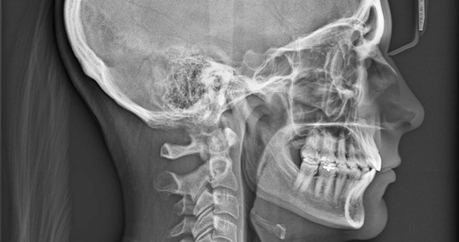 في حدث طبي نادر.. العلماء يكتشفون أعضاء جديدة بجسم الإنسان