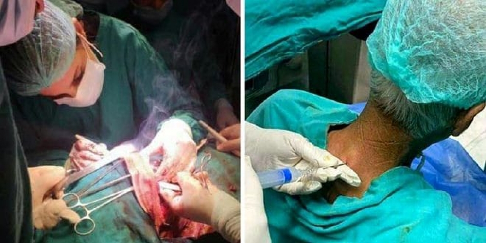 الصحة: فريق طبي سوري يجري عمل جراحي الأول من نوعه في سورية والحادي عشر عالمياً