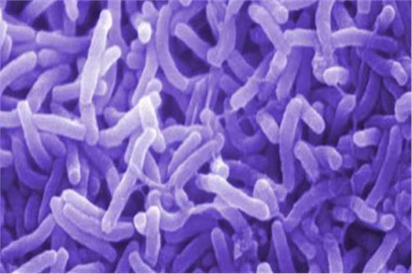 إسبانيا تسجل أول حالة إصابة بالكوليرا منذ العام 1979