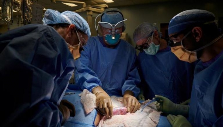 في خرق علمي جديد .. علماء يتمكنون من إحياء أعضاء خنزير بعد ساعة من موته