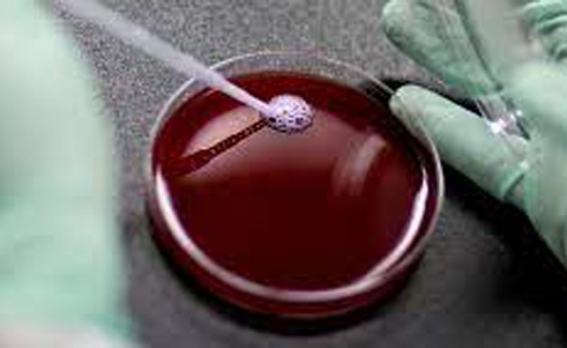 فحص الدم يكشف سرطان القولون والمستقيم