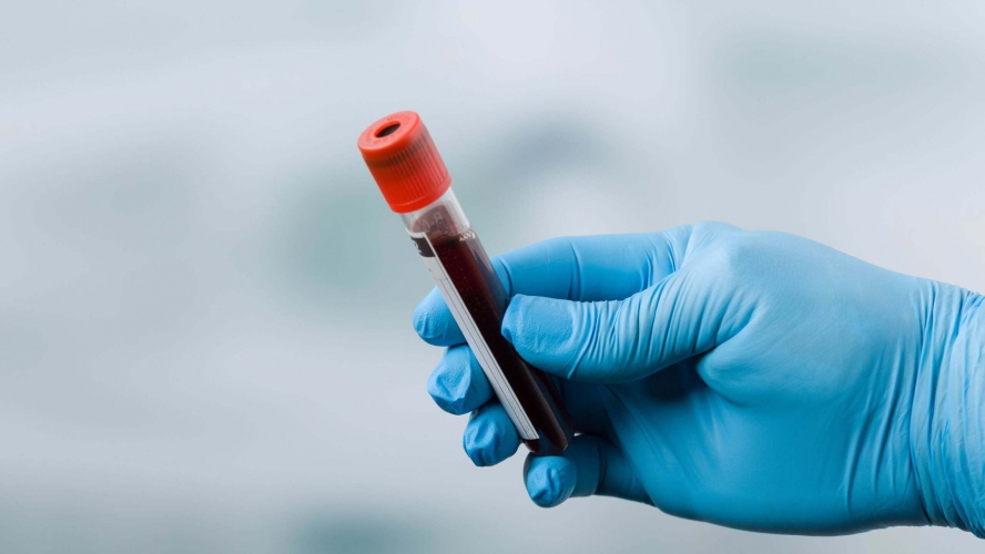 روسيا تسجل رسميا دواء فعال لعلاج سرطان البروستات