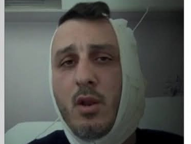 سوري يقطع أذن سائح إسرائيلي في اليونان.. وتل أبيب تعلّق