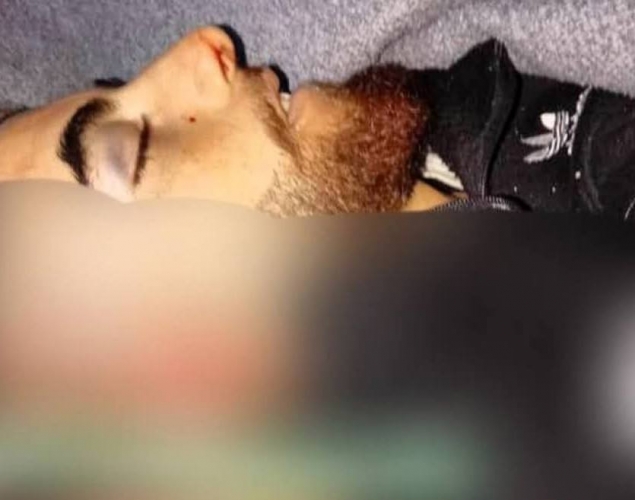 استشهاد 3 مواطنين وإصابة آخرين باستهداف حافلة في قرية كفر مارس بإدلب