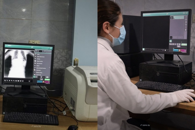 مشفى السقيلبية يواجه ضغطاً متزايداً ونقصاً حاداً في أجهزة التصوير الشعاعي