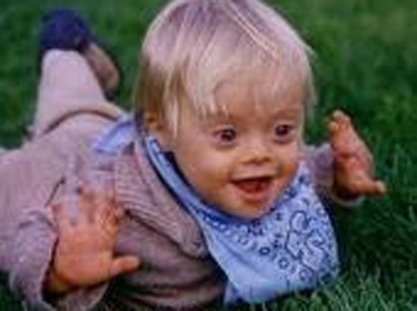 باحثون فرنسيون يرصدون تحولاً جينياً وراء التخلف العقلي الوراثي