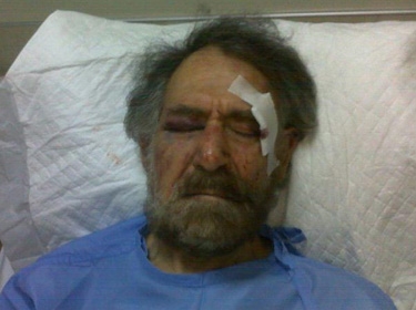 اتحاد الصحفيين يدين الاعتداء على فرزات