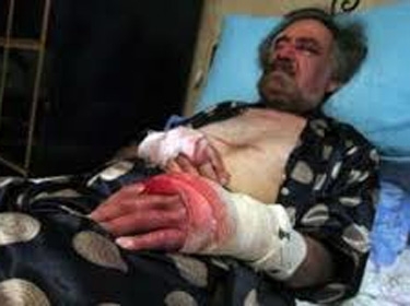 جهات معارضة تقف وراء الاعتداء على الفنان علي فرزات