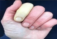 مرض نادر يصيب مذيعة بريطانية